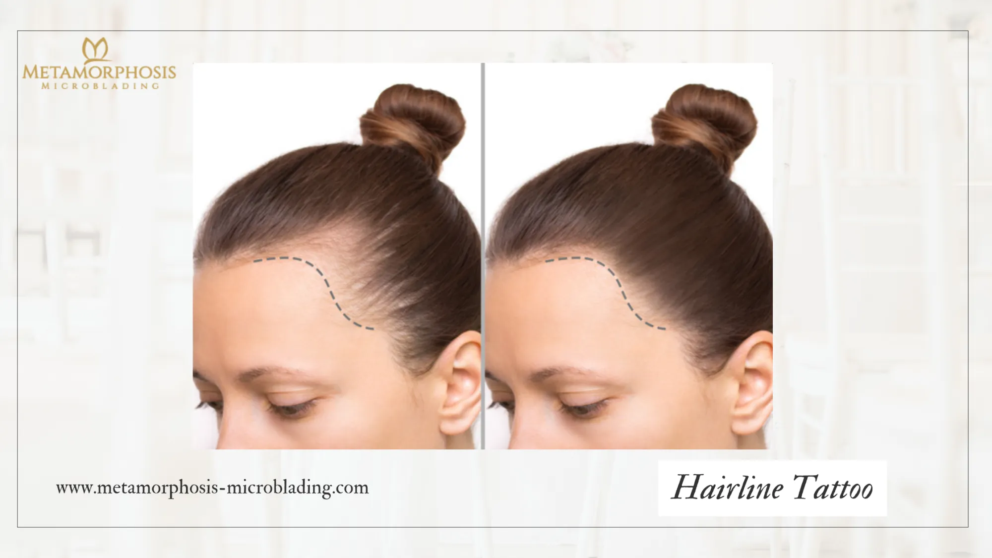 Hairline Tattoo: What It Is, Who It's For, and What to Expect