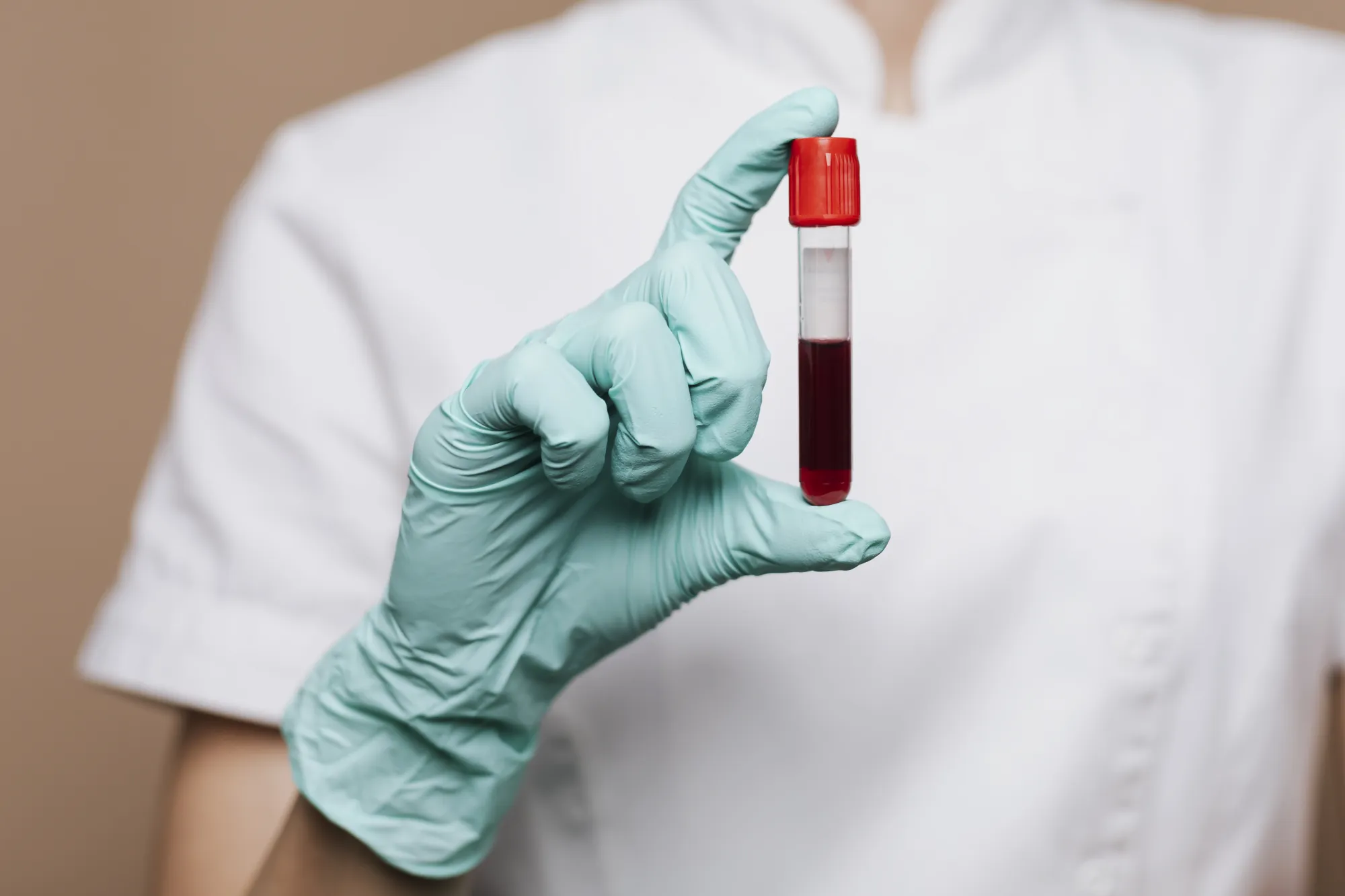 Advanced Lipid Profile Test: A Smarter Way to Assess Your Heart Health