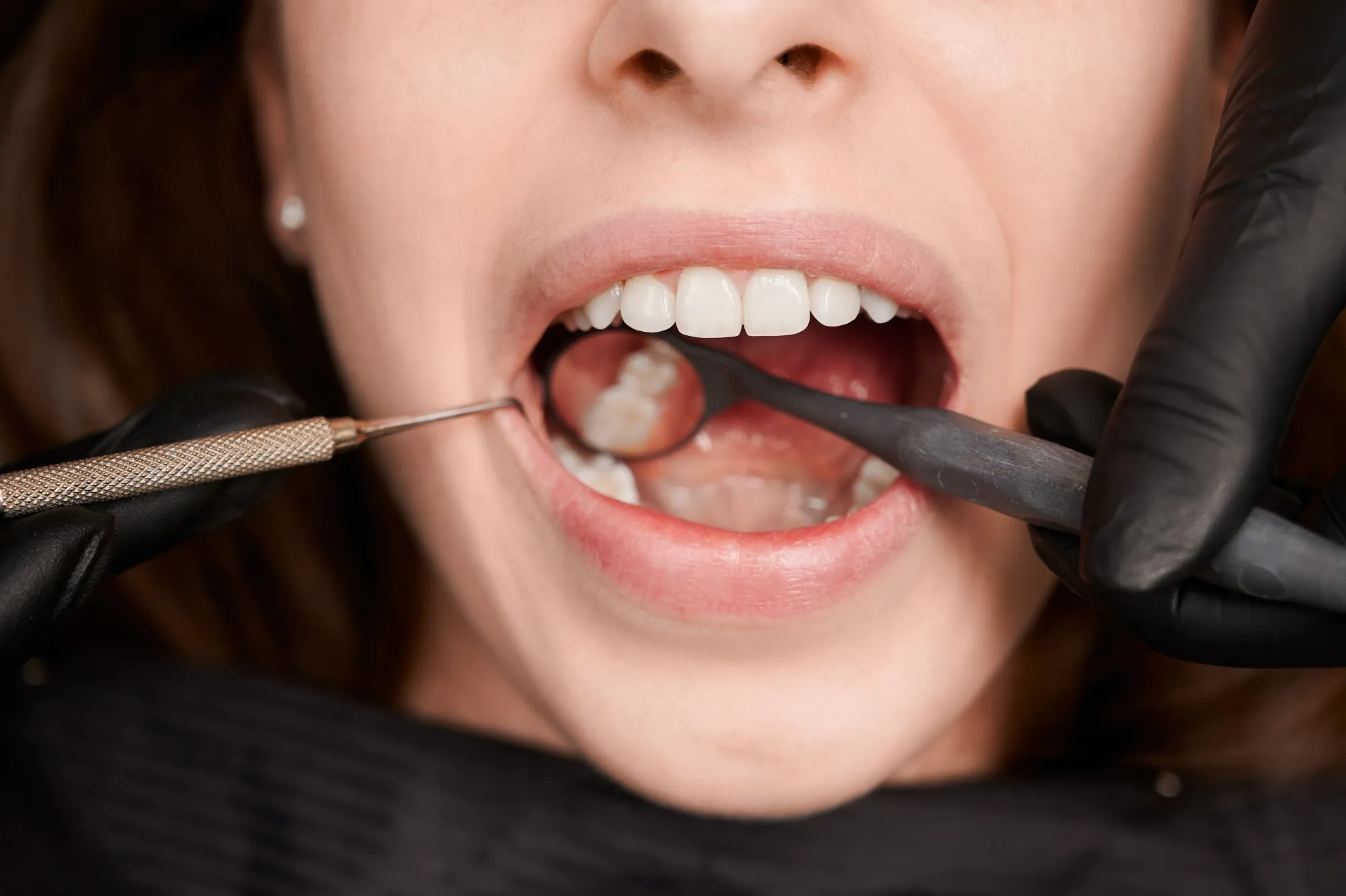 Finding a Dentist in Crystal Palace for Nervous Patients