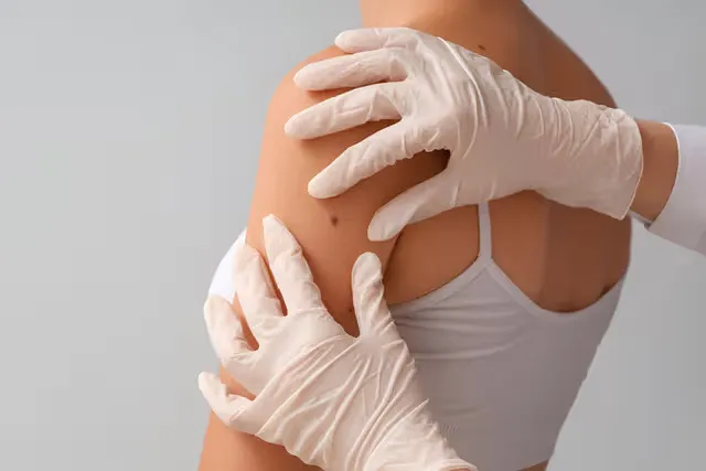 Why Choose Dr Safwan for Skin Cancer Treatment in Australia?