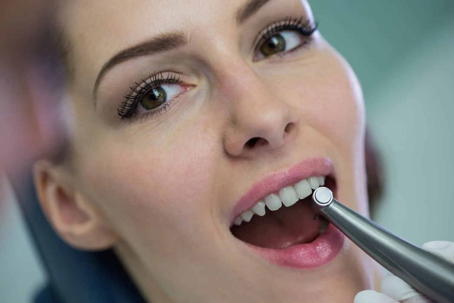 Composite Restorations in Mason for Natural Looking Results