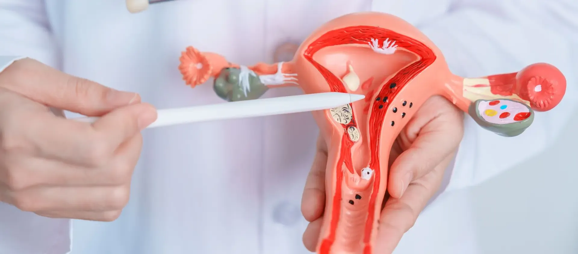 Endometriosis Fertility Treatment Options Explained