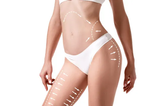 Why More People Choose Fat Removal Surgery