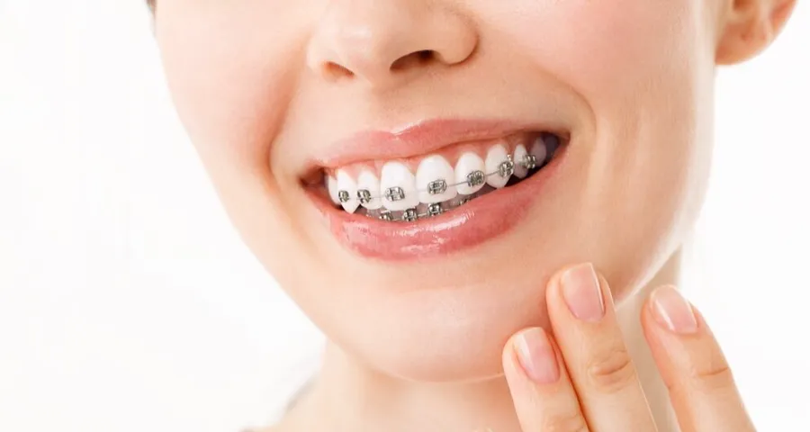Essential Oral Hygiene Tips During Braces Treatment