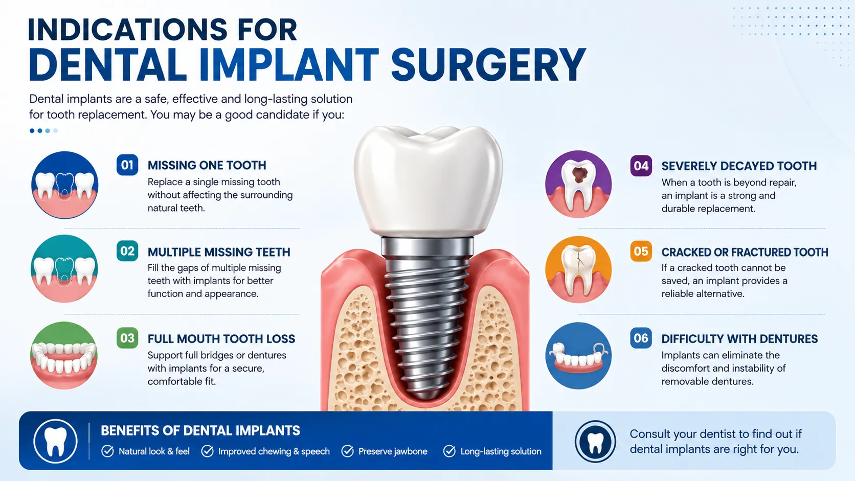 Dental Implants in Chennai