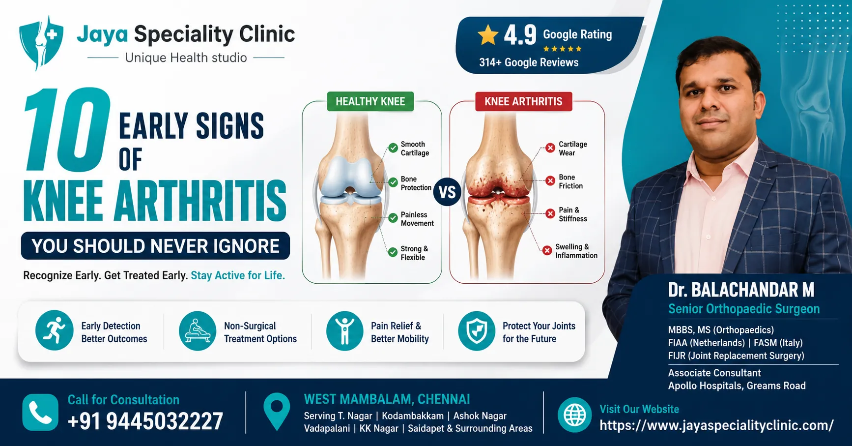 10 Early Signs of Knee Arthritis You Should Never Ignore