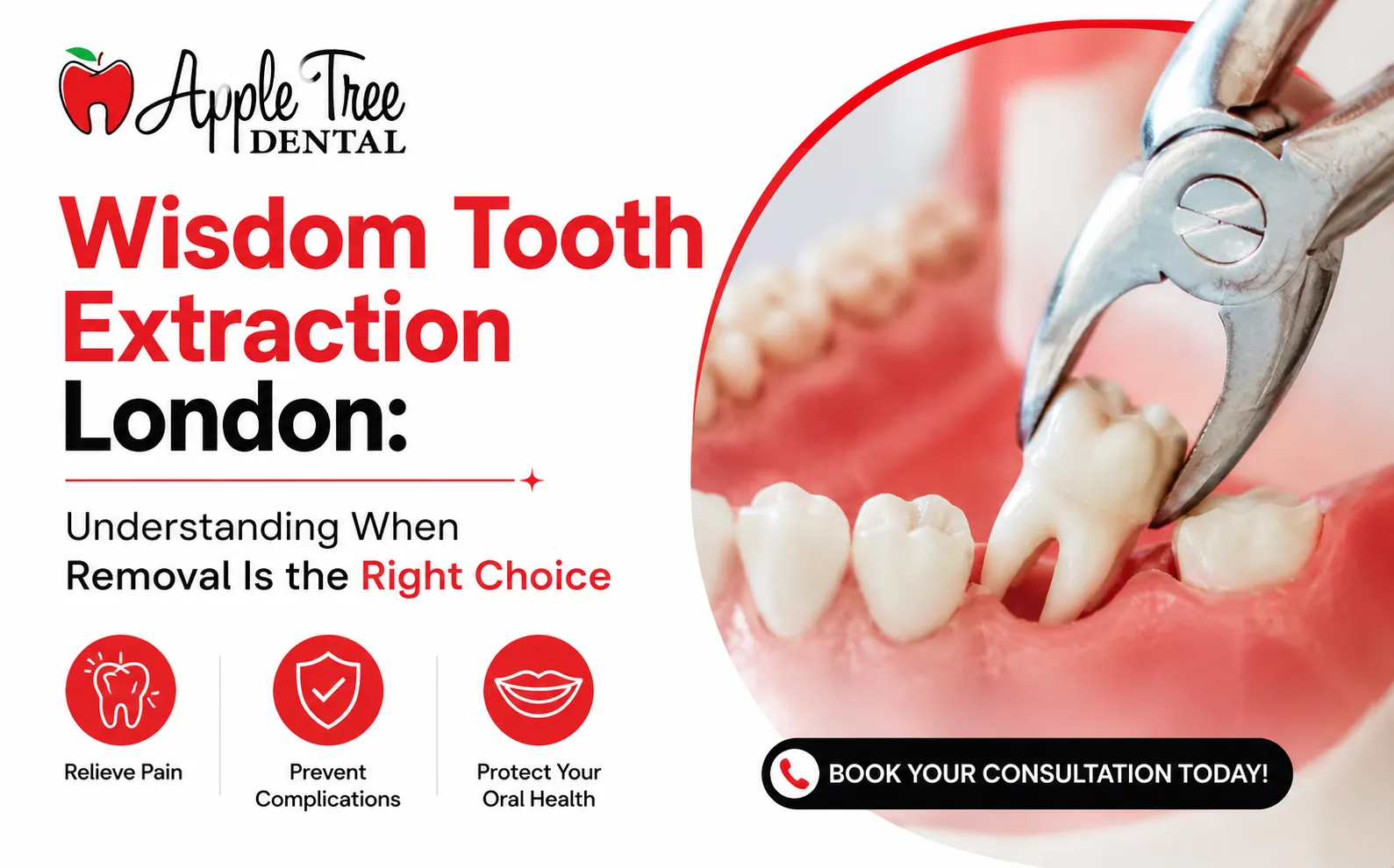 Wisdom Tooth Extraction London: Understanding When Removal Is the Right Choice