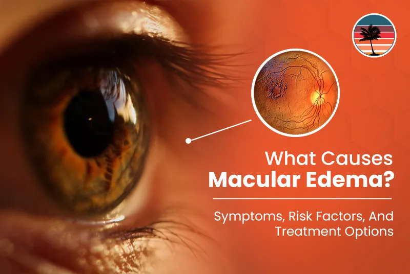 What Causes Macular Edema and When Should You Seek Medical Attention?