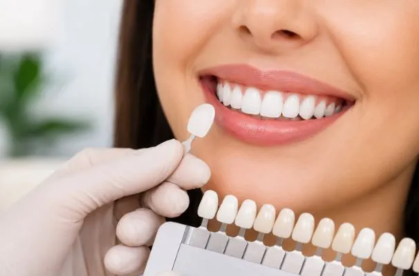 Why Composite Veneers Are a Popular Cosmetic Dentistry Solution?