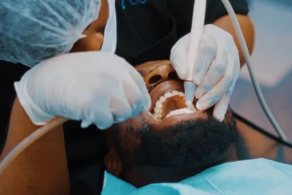 A Cleaner, Healthier Smile: Why Scaling and Polishing Deserves a Place in Your Dental Routine