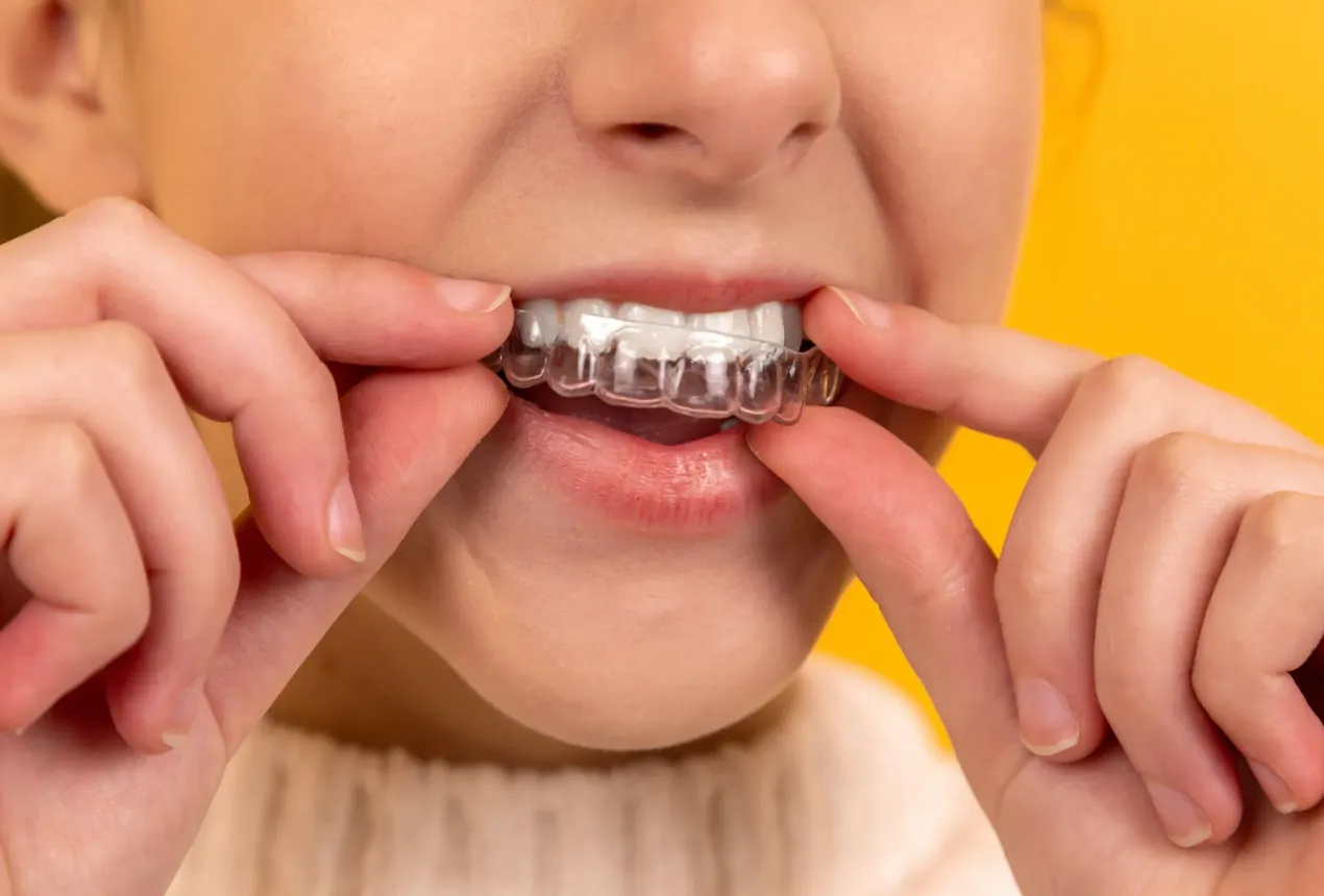 Who Offers the Fastest Invisalign Treatment? A Complete Guide for Teens and Adults