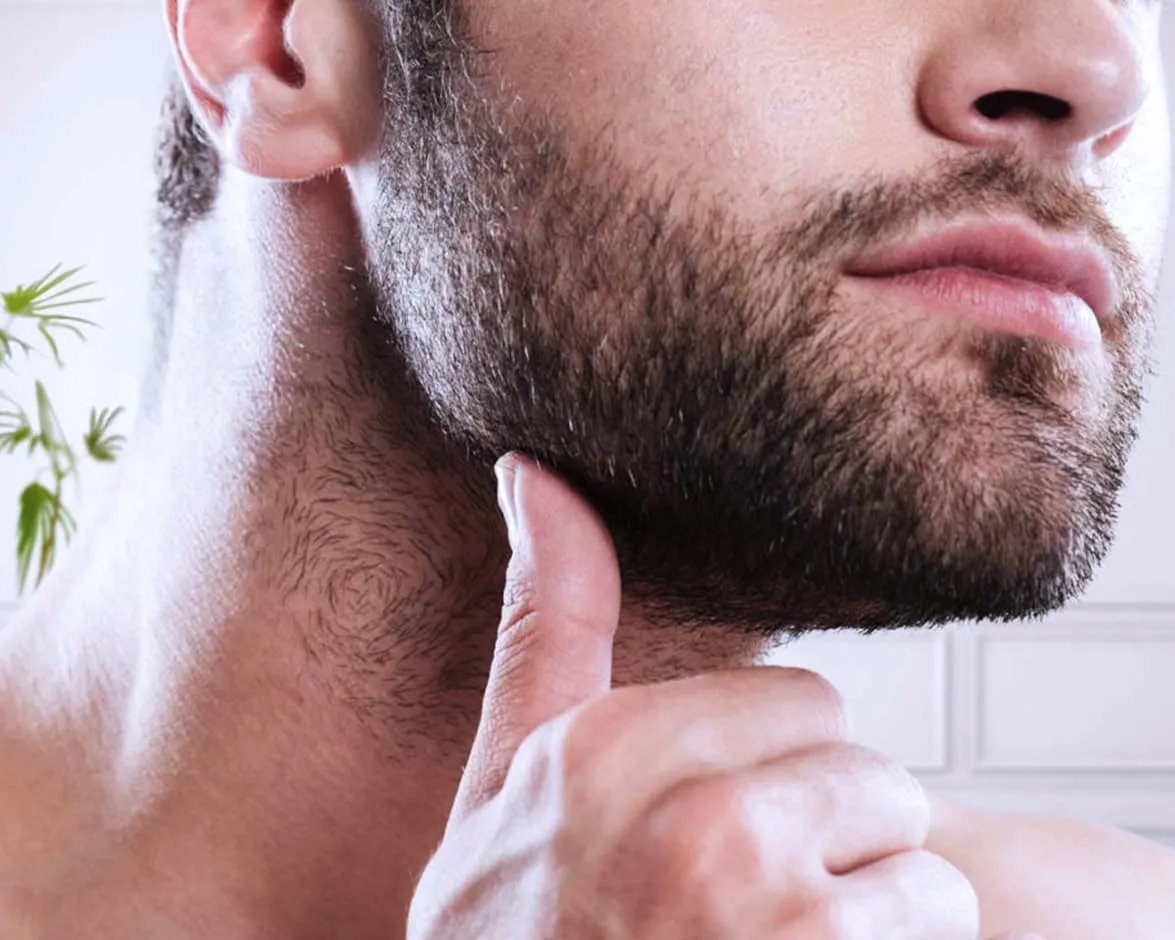 What Happens During Beard Hair Transplants?