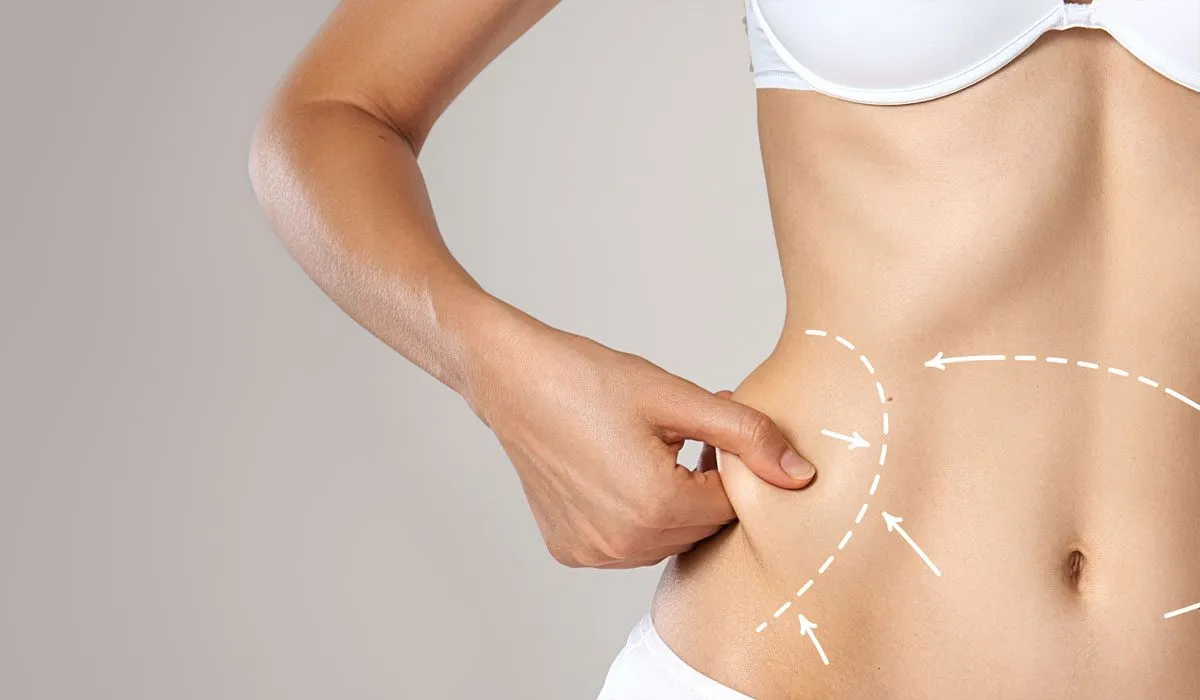Liposuction Before and After