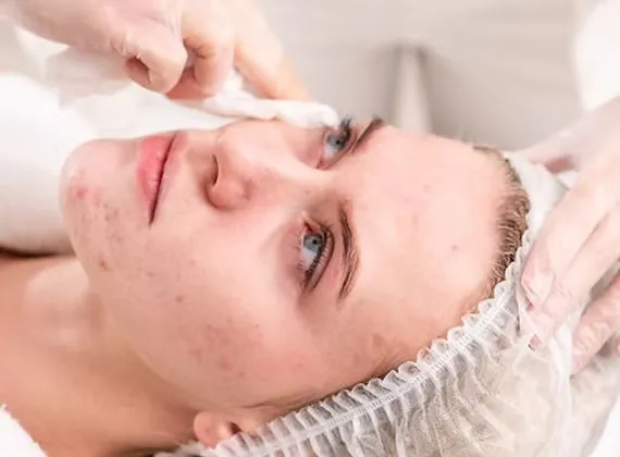Laser Resurfacing Treatment: Your Complete Guide to Radiant Skin