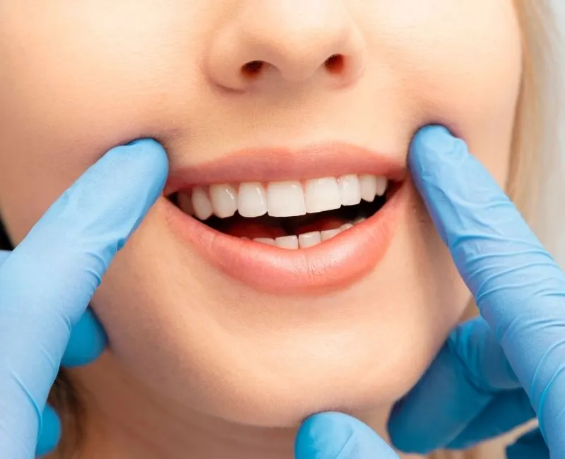 What Dental Services Should You Expect From a Bexley Dental Clinic?