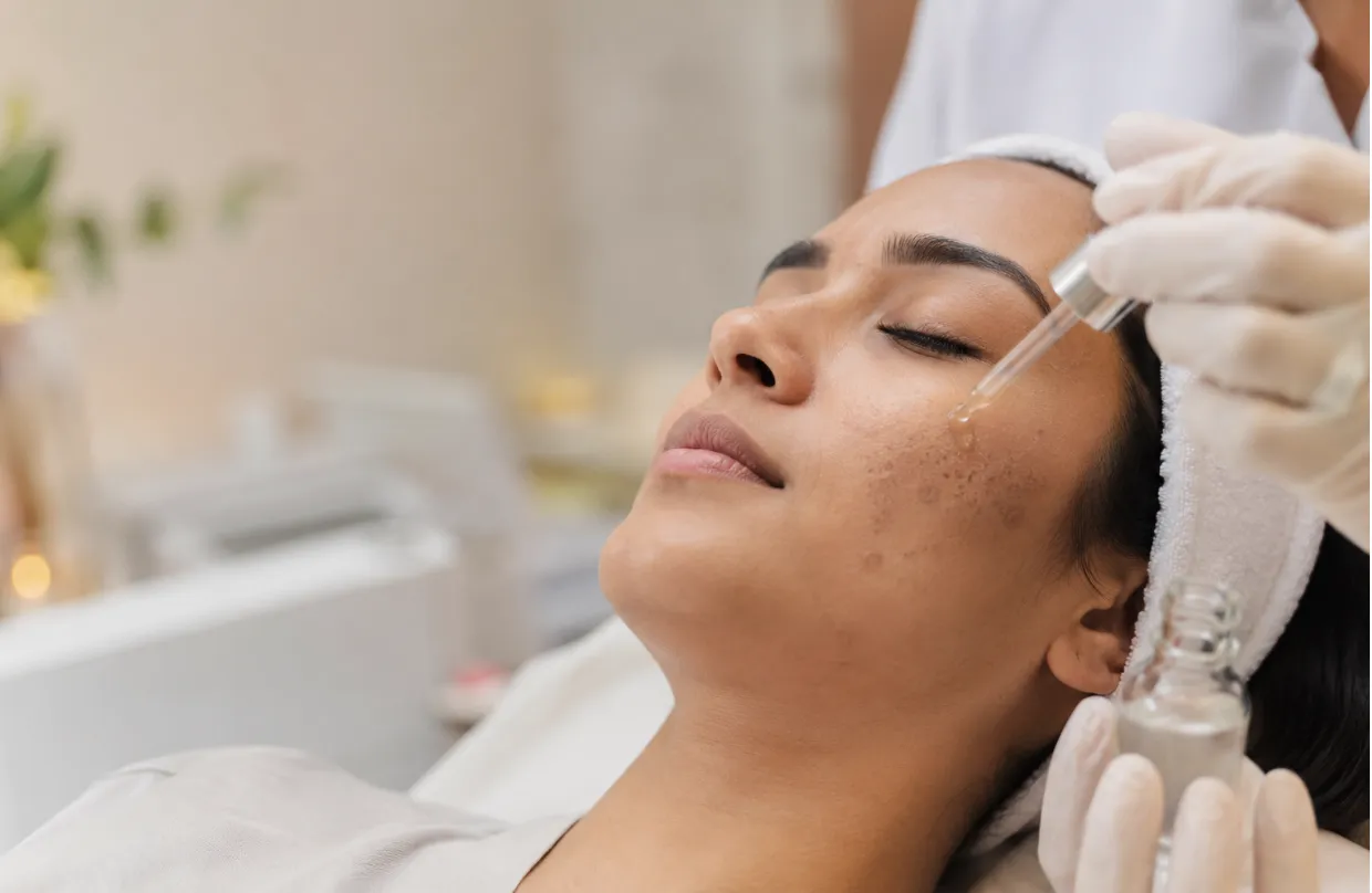 Skin Pigmentation Treatment in Nagpur: What Actually Works for Dark Spots?