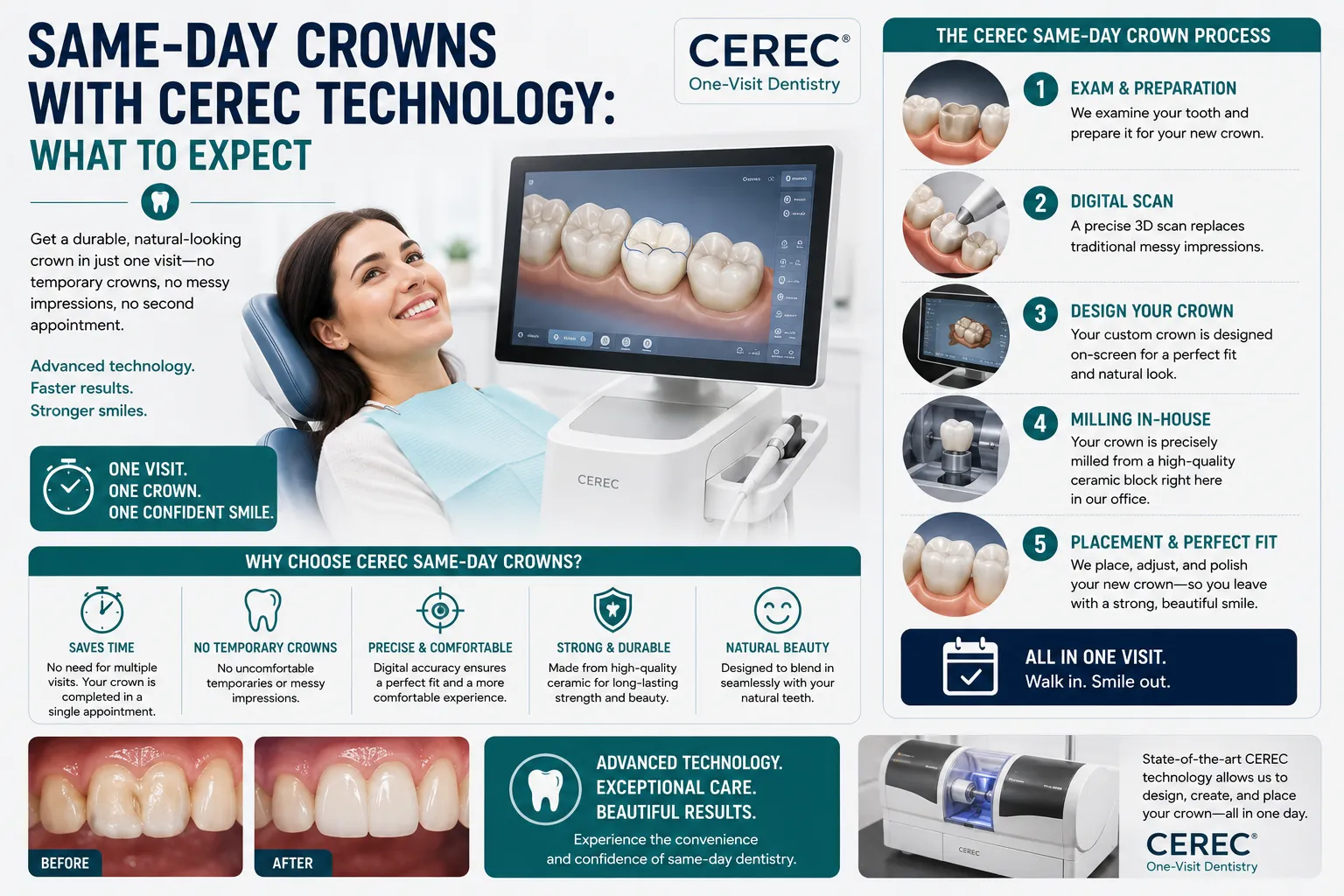 "Same-Day Crowns with CEREC Technology: What to Expect" – Highlights your practice's specific tech advantage.