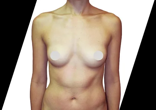 What Procedures Are Available at an Aesthetic Center for Plastic Surgery?