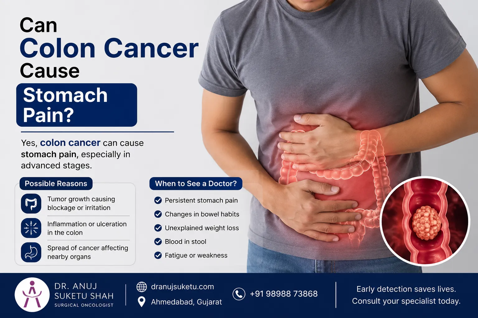 Can Colon Cancer Cause Stomach Pain?