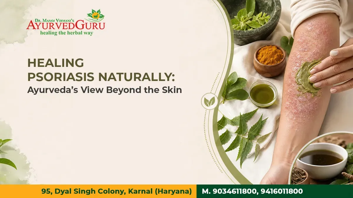Healing Psoriasis Naturally: Ayurveda’s View Beyond the Skin