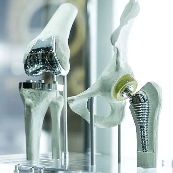 Severe Knee or Hip Pain? Here’s When Joint Replacement May Help
