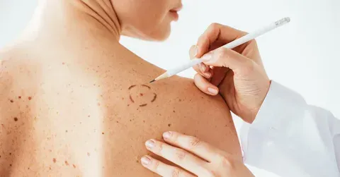 Why Choose Dermatology and Skin Cancer Specialists?