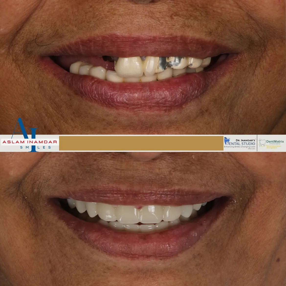Dr. Inamdar's Dental Studio: Mumbai's First Fully Digital Dental Practice
