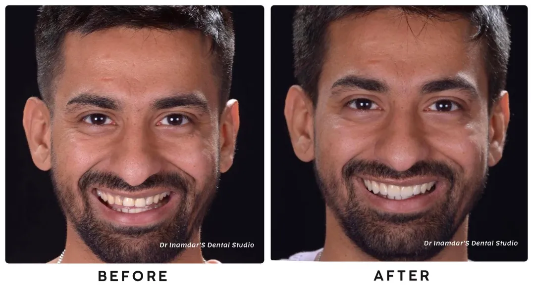 Dr. Inamdar's Dental Studio: Mumbai's First Fully Digital Dental Practice