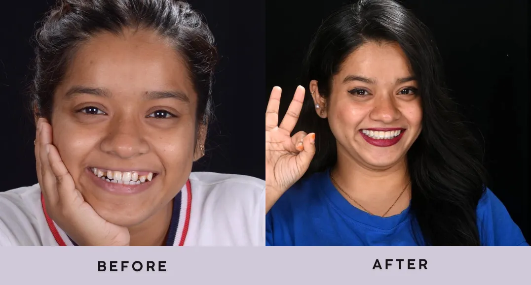 Dr. Inamdar's Dental Studio: Mumbai's First Fully Digital Dental Practice