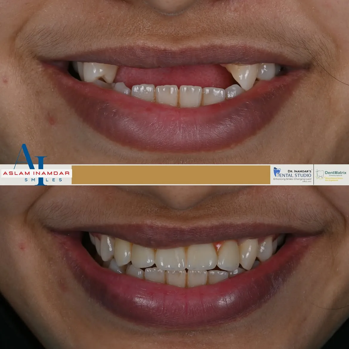 Dr. Inamdar's Dental Studio: Mumbai's First Fully Digital Dental Practice