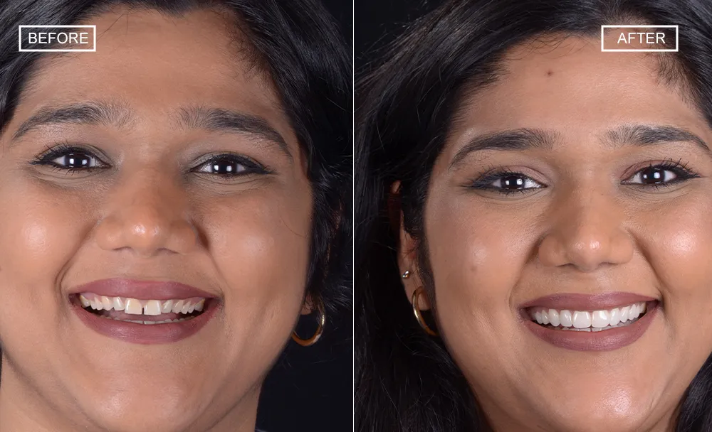 Dr. Inamdar's Dental Studio: Mumbai's First Fully Digital Dental Practice