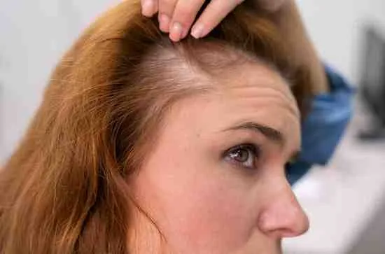 Thyroid Hormones and Hair Loss: How to Recognize When Hormones Are Behind Thinning Hair