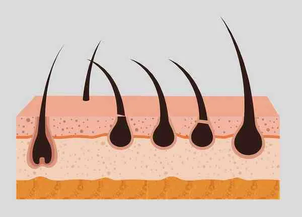 Thyroid Hormones and Hair Loss: How to Recognize When Hormones Are Behind Thinning Hair