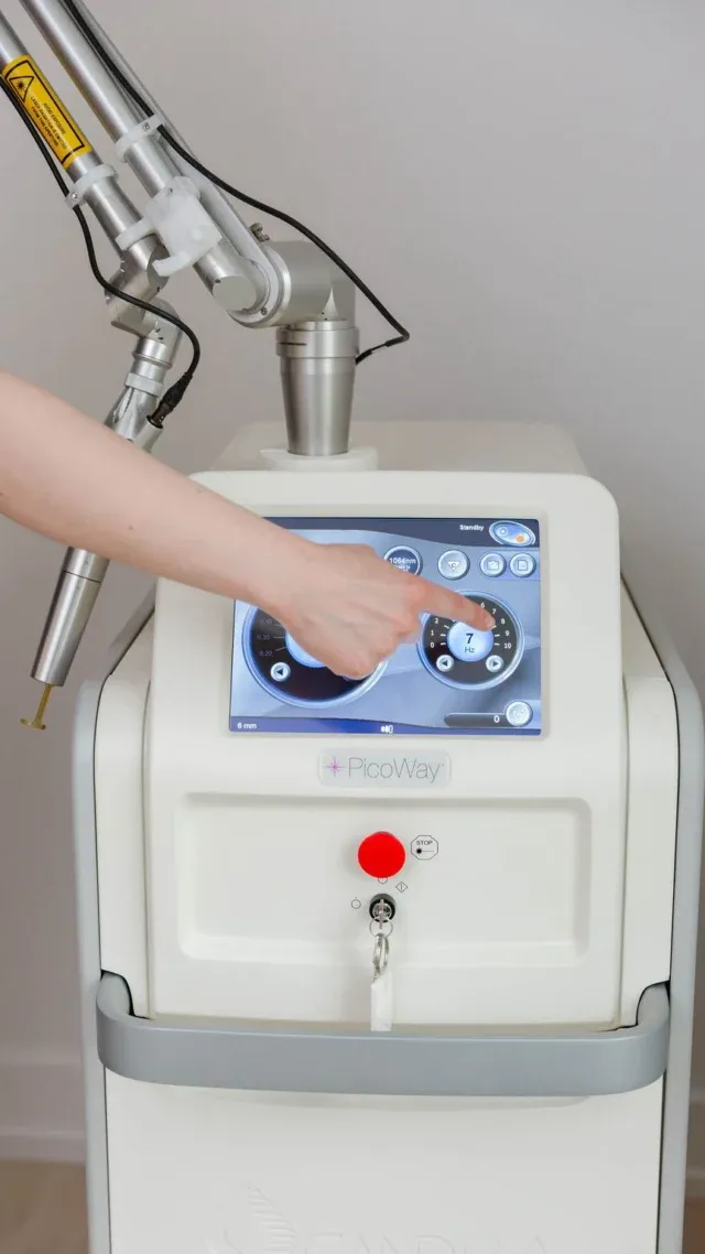 Ready to Move On From Old Ink? Your Laser Removal Guide