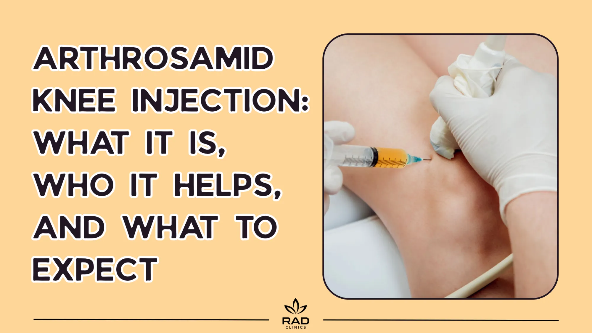 Arthrosamid Knee Injection: What It Is, Who It Helps, and What to Expect