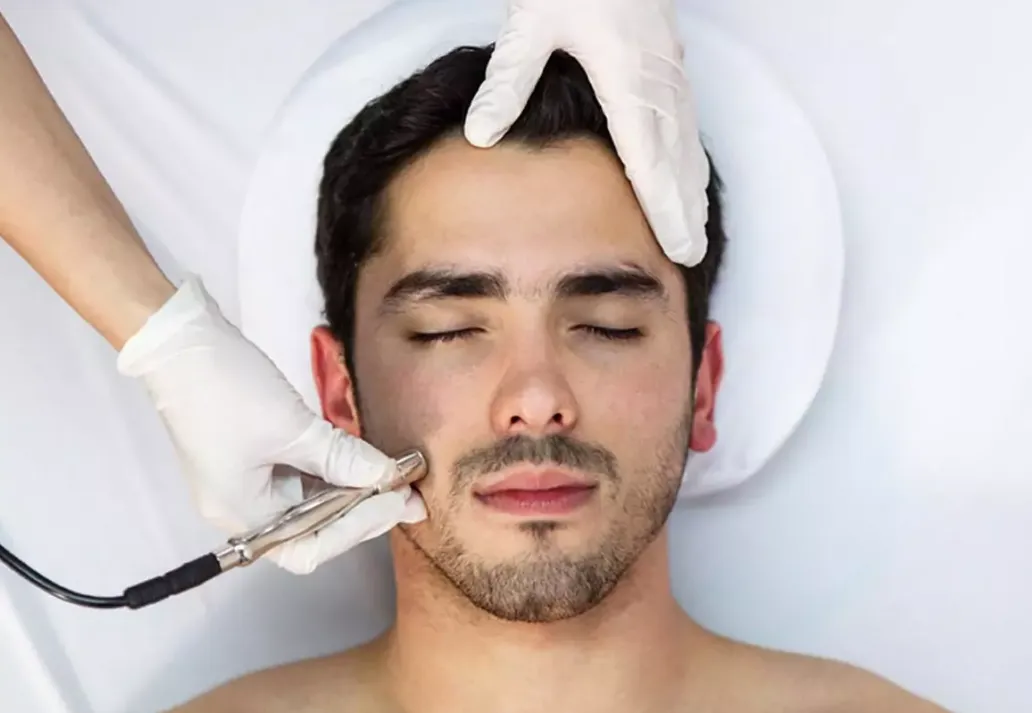 Aesthetic Clinics Cape Town: Micro Needling for Healthier-Looking Skin
