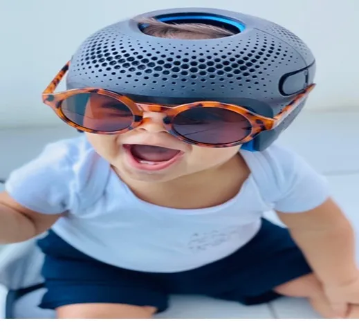 How Infant Head Shape Changes During the First Year