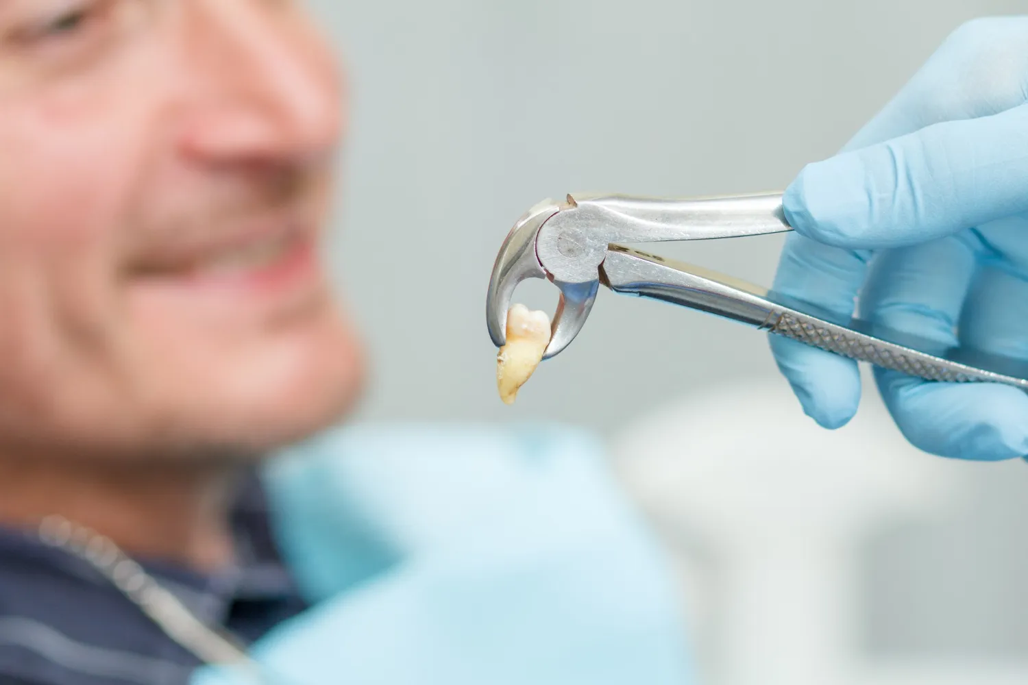 Tooth Extractions Thousand Oaks: Common Questions Answered