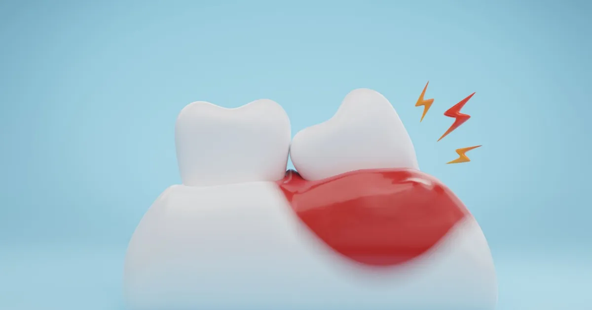 The Best Tablet for Toothache: Your Guide to Pain Relief in Lahore