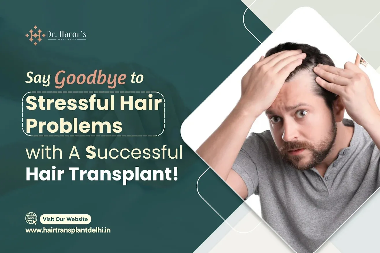 Say Goodbye to Stressful Hair Problems with A Successful Hair Transplant!