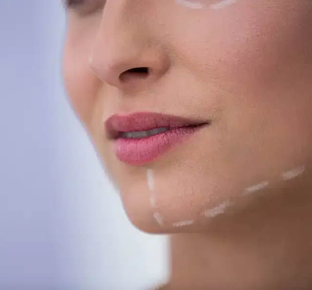 Chin augmentation surgery cost in Delhi - Dr Rajat Gupta