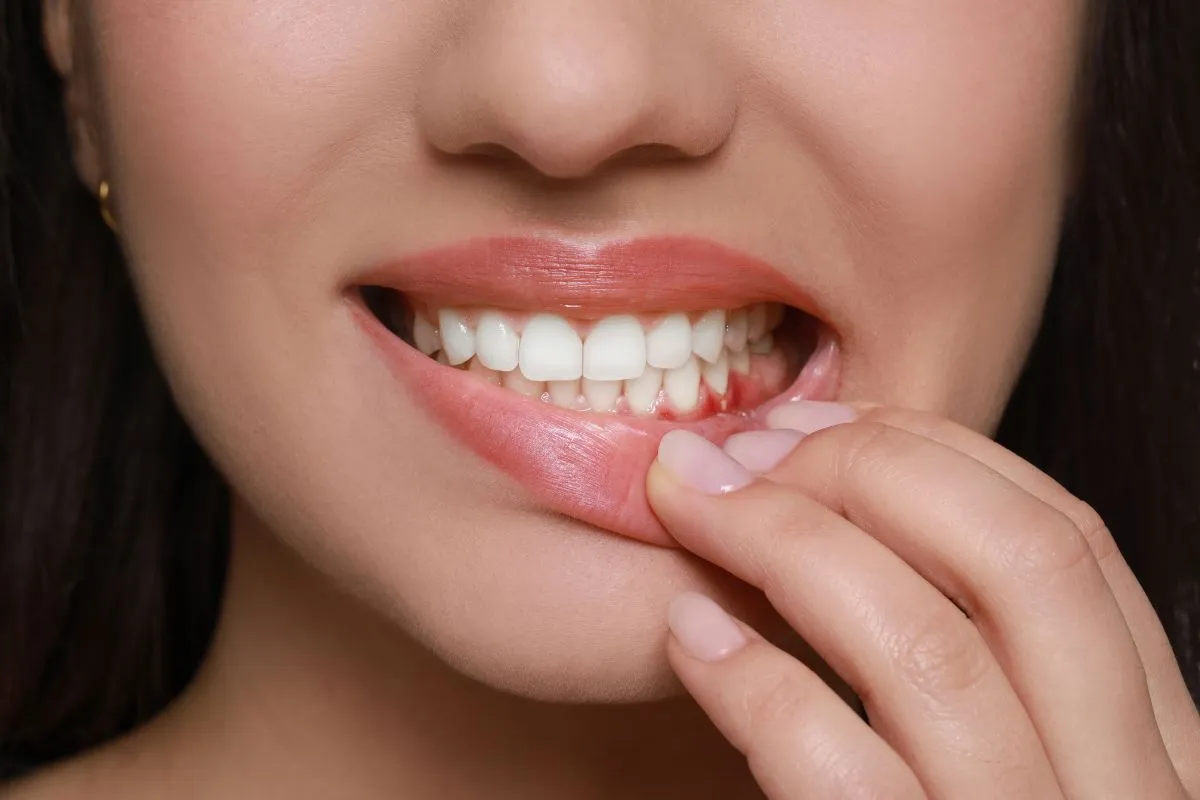 Is Your Toothbrush Making Your Gums Recede? Here's What to Know