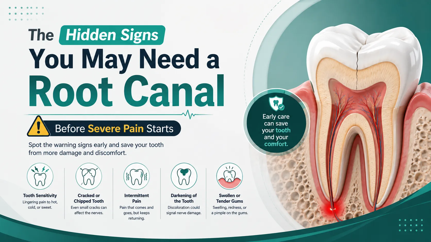 The Hidden Signs You May Need a Root Canal — Before Severe Pain Starts