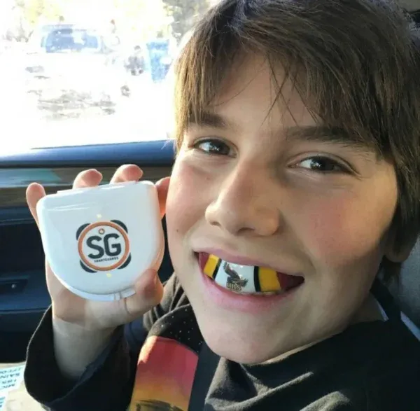 Smartguards: A Personalized Approach to Sports Mouth Protection