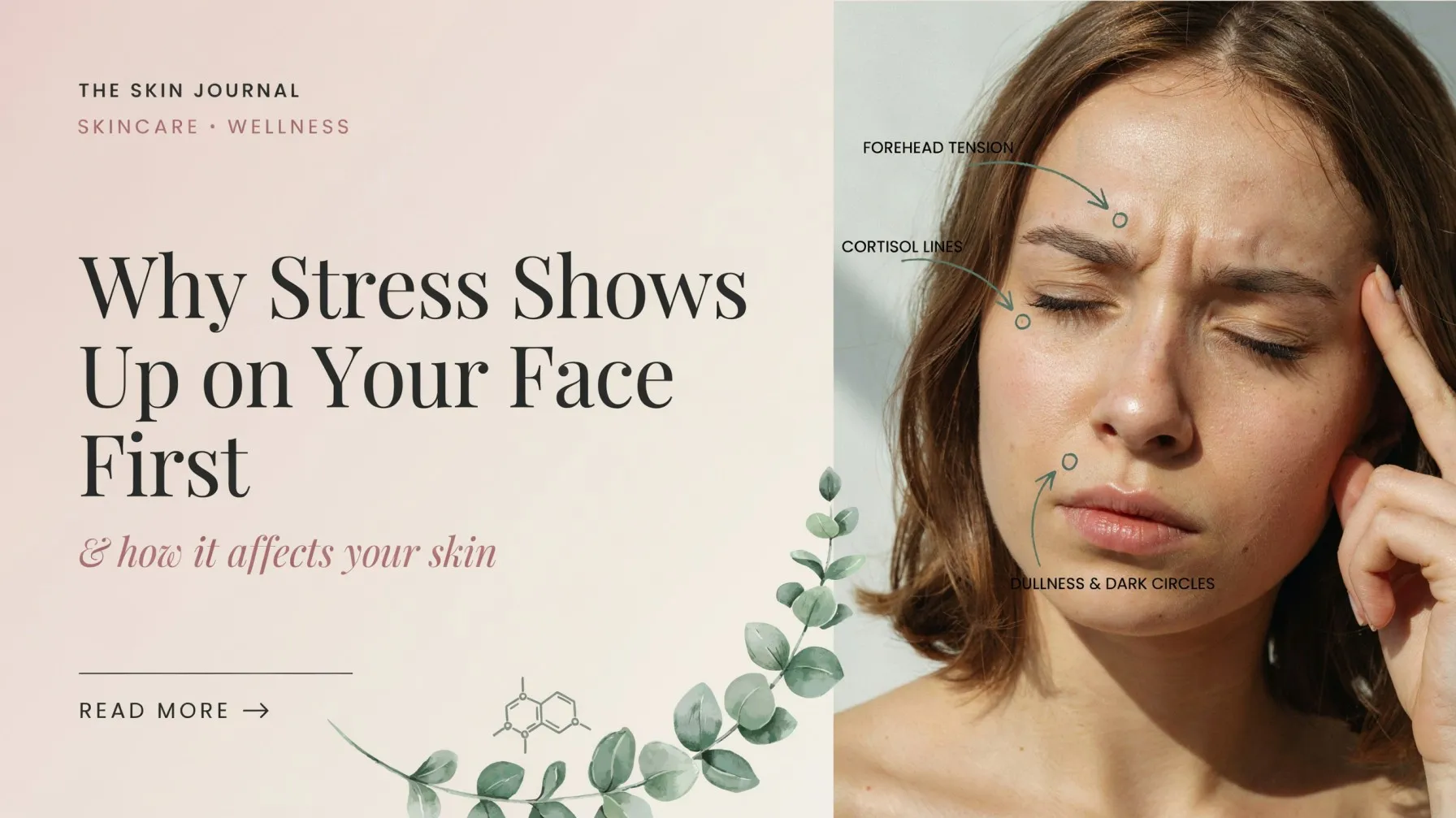 Why Stress Shows Up on Your Face First and How It Affects Your Skin?