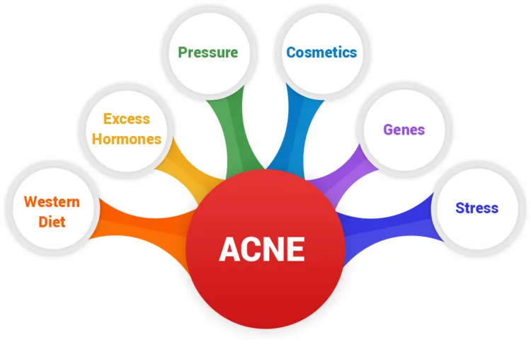 How a Naturopathic Doctor Can Help Treat Acne