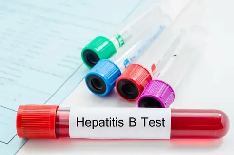 Hepatitis B and C Test Price in Lahore: Complete Guide for Pakistan