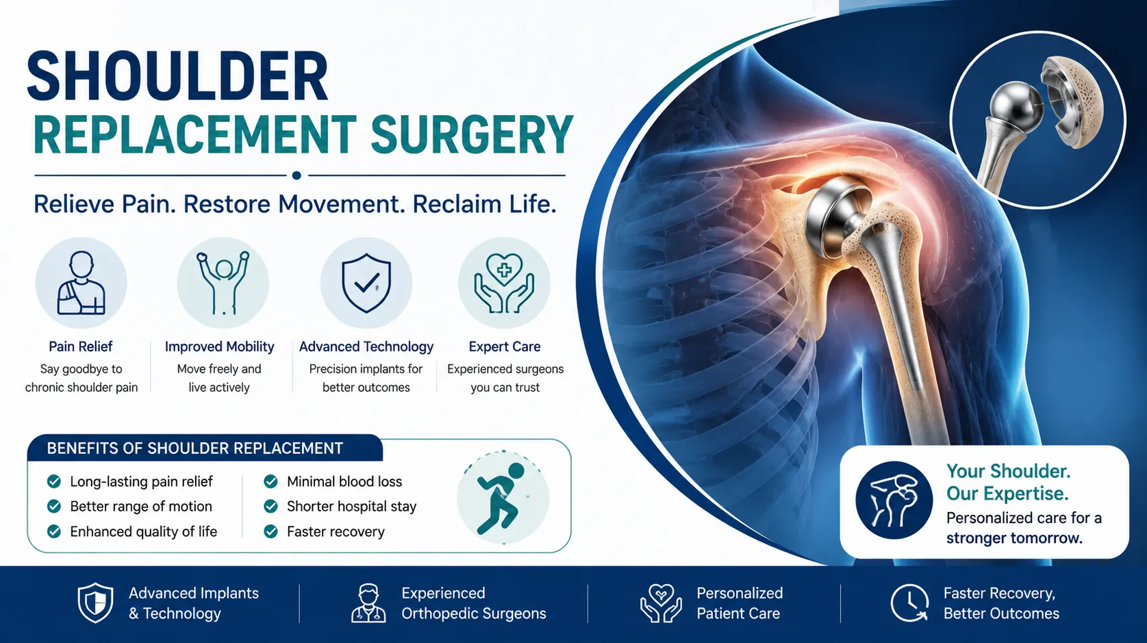 Can You Fully Move Your Arm After Shoulder Replacement Surgery?