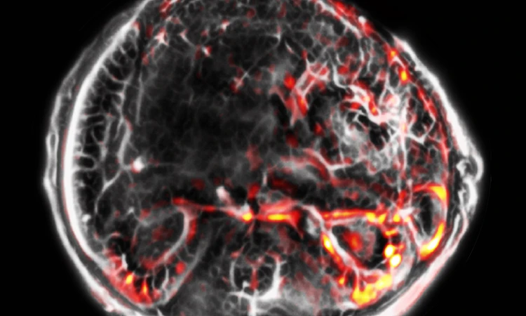 Demand for Photoacoustic Tomography Market is expected to surge at a CAGR of 15.0% forecast to 2022-2032