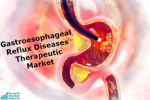 Gastroesophageal Reflux Diseases Therapeutic Market – Growth Market Reports